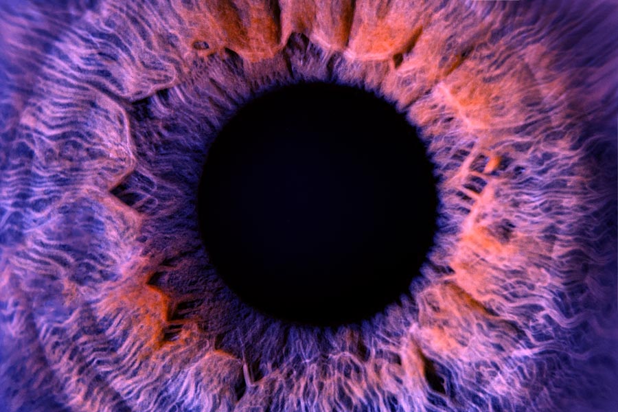 Auge